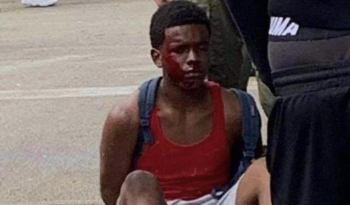 Il poliziotto bianco brutalizza un ragazzino nero: il video diventa virale e cresce la rabbia
