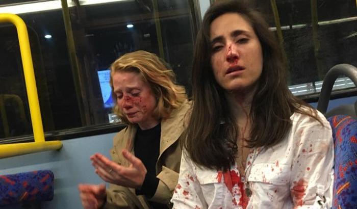 "Baciatevi, lesbiche": due ragazze picchiate e derubate da quattro teppisti a Londra