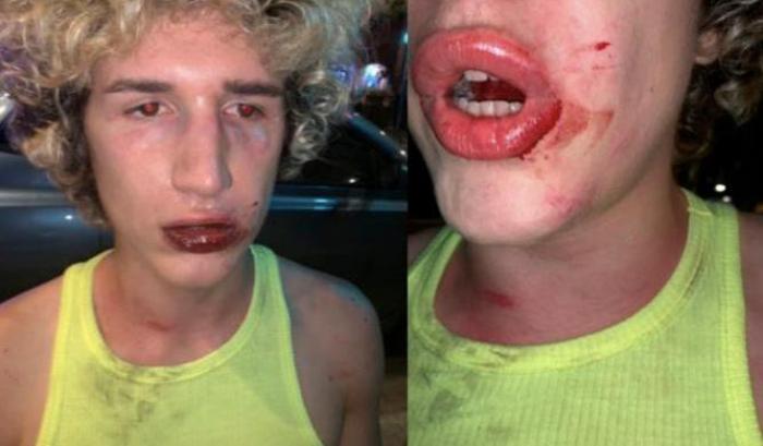 Aggressione omofoba a Valencia: due ragazzi italiani aggrediti in strada