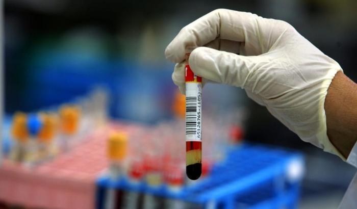 Arrivano nuove analisi del sangue per 20 tipi cancro, i test ad Harvard