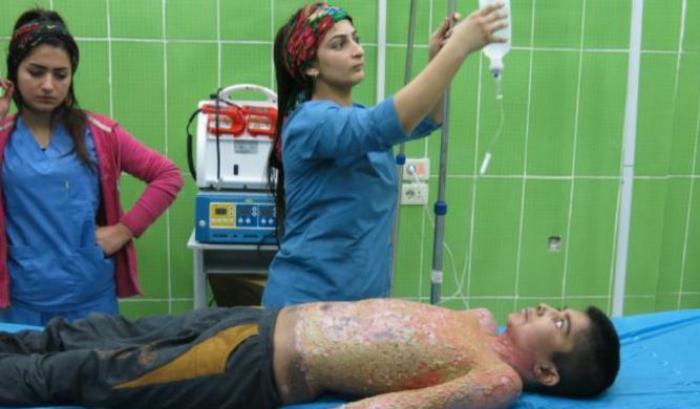 Vendute dal Regno Unito alla Turchia le armi chimiche usate per sterminare i curdi