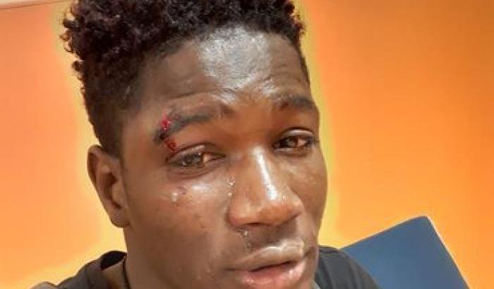 Ancora razzismo. Un ventenne italiano accerchiato e picchiato a Palermo: è di origini senegalesi