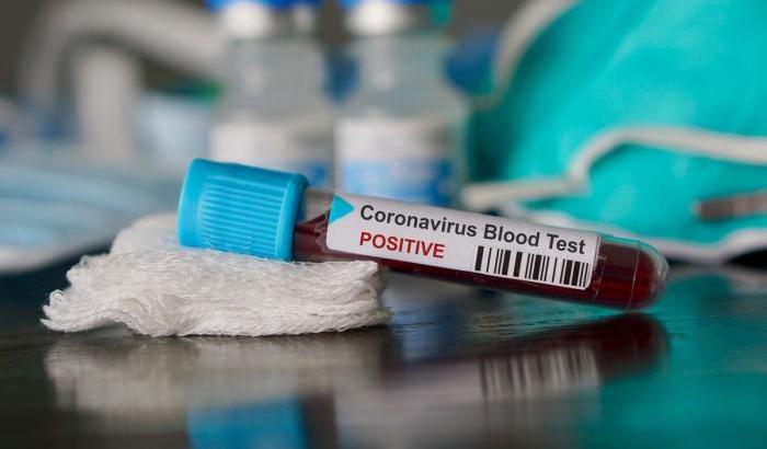 L'immunologo: "Sconfiggeremo Covid-19 non è 'furbo' come l'Hiv e non è capace di mutare"