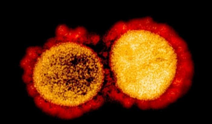 Coronavirus