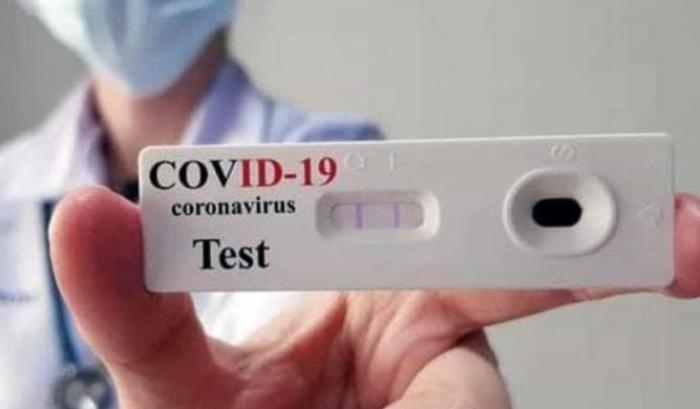 000566C1-test-sierologico Test sierologico