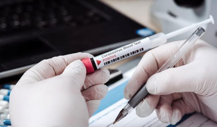 I virologi sul Covid isolato a Brescia: "È realmente una variante molto meno aggressiva"