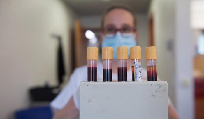 Altri 190 casi in più, 88 sono in Lombardia