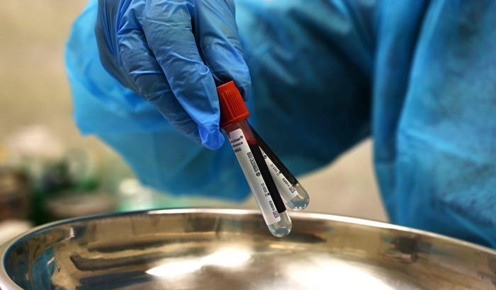 00056F85-test-covid Coronavirus