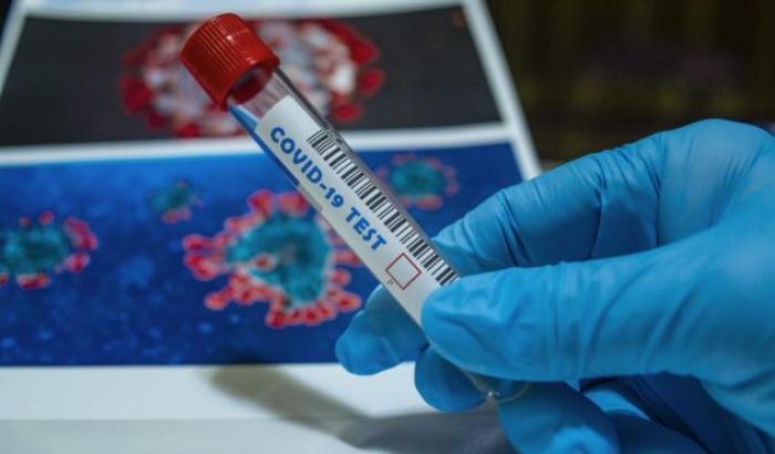 0005722F-coronavirus Coronavirus