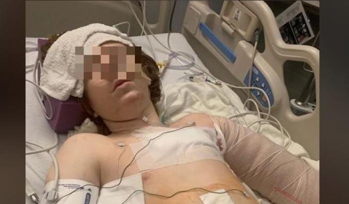 Ancora violenza negli Usa: a Utah la polizia spara ad un 13enne autistico con una crisi