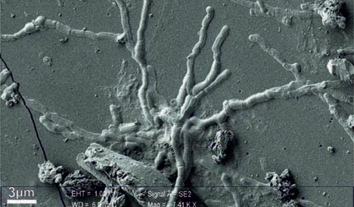 Trovati neuroni umani millenari nel cervello di una vittima del Vesuvio