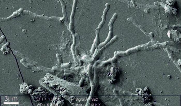 00058089-neuroni-umani Neuroni umani