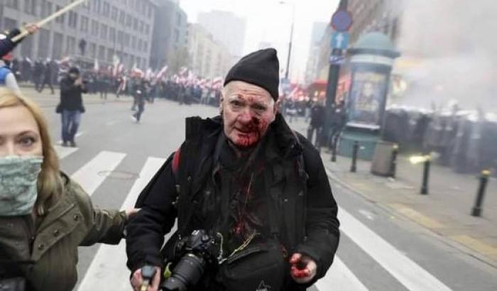 Gli estremisti di destra in piazza in Polonia nonostante i divieti: scontri con la Polizia