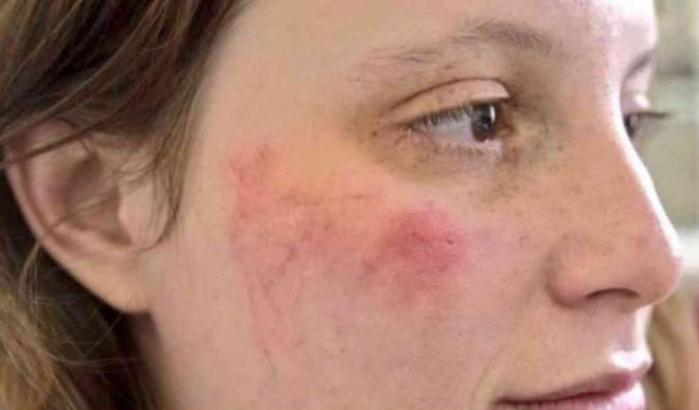 Dopo lo scontro con la polizia, la figlia di Calenda: "In Francia la tensione è alta, temo dei morti"