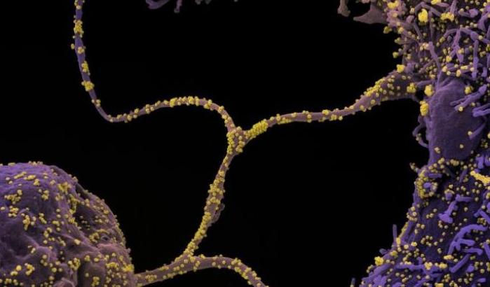 Arrivano nuove prove: la variante sudafricana del Covid è più contagiosa