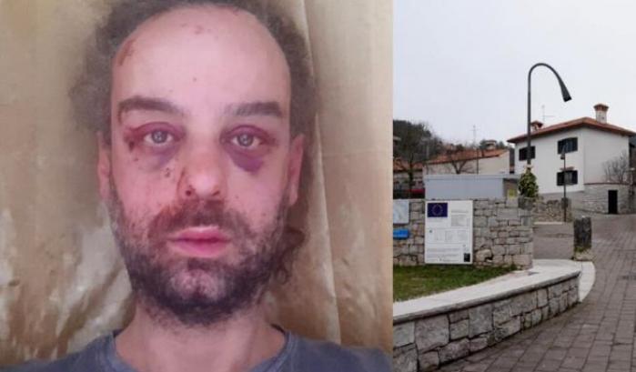 Mentre i politici reazionari negano l'omofobia, un'attivista è stato pestato a sangue in Friuli