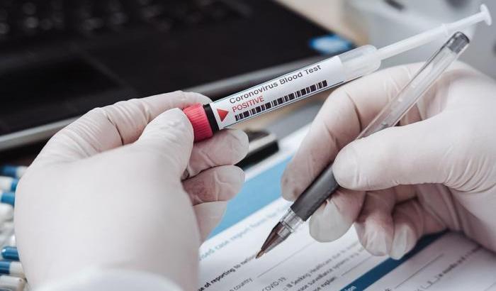 In Francia sviluppato un test Covid tre volte più rapido degli antigenici