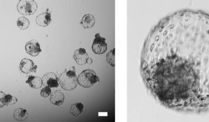 Arrivano i primi embrioni umani sintetici ottenuti da cellule modificate