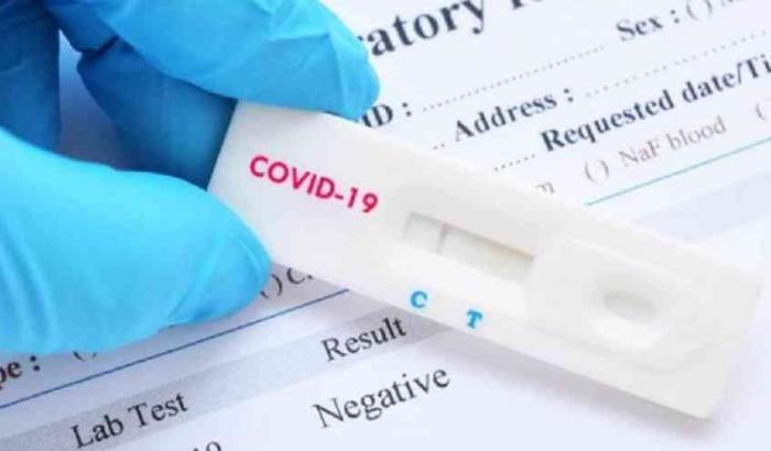 0005A65A-tampone-covid Tampone Covid