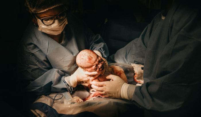 Un parto più unico che raro: aspettava sette gemelli ma alla fine ne nascono nove