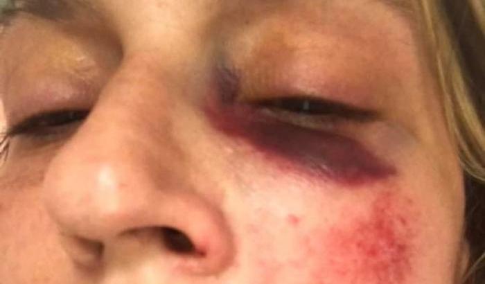 Beatrice  Lucrezia Orlando, la donna picchiata