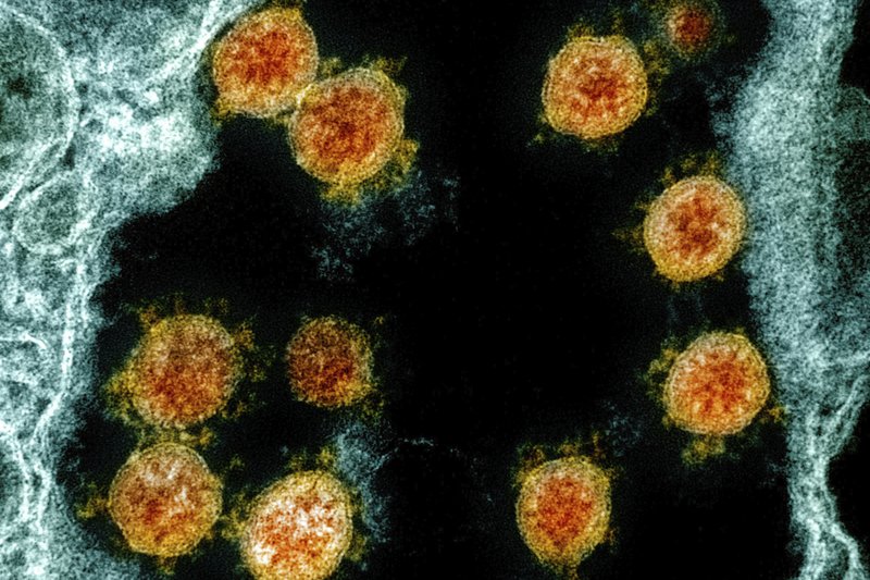 Inventato uno schermo protettivo che nasconde al Coronavirus l'ingresso della cellula