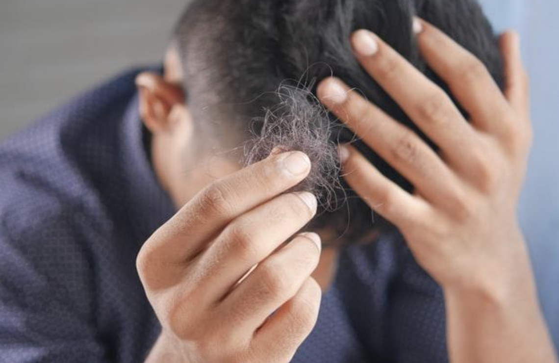 Bellezza: cosa sapere sul trattamento per capelli diradati