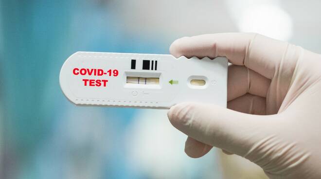 Si è scoperto che gli under 30 guariti dal Covid hanno bassi livelli di anticorpi