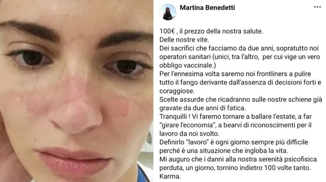 Il legittimo sfogo di un'infermiera:"100 euro è il prezzo della nostra salute e di due anni di sacrifici?"