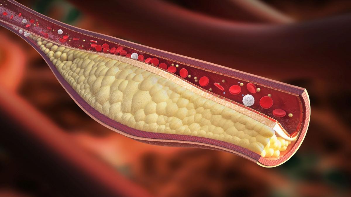 Una tipologia di cibo può combattere il colesterolo: secondo uno studio può sostituire i farmaci