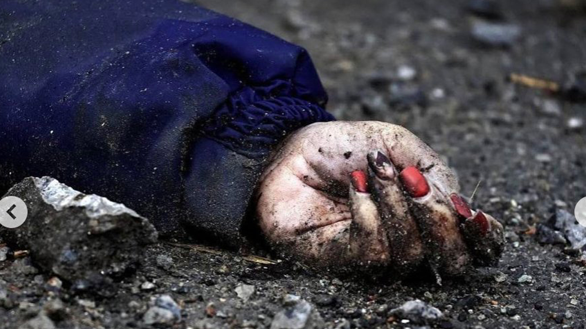 L'Onu parla di 9.300 vittime civili in Ucraina ma i numeri reali sono molto più alti