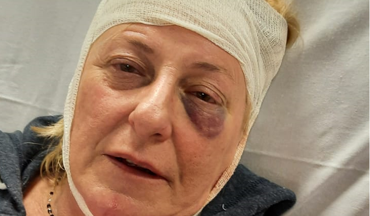 Le urla 'lesbica di m**da' e la getta dalle scale: in ospedale una donna di Alessandria