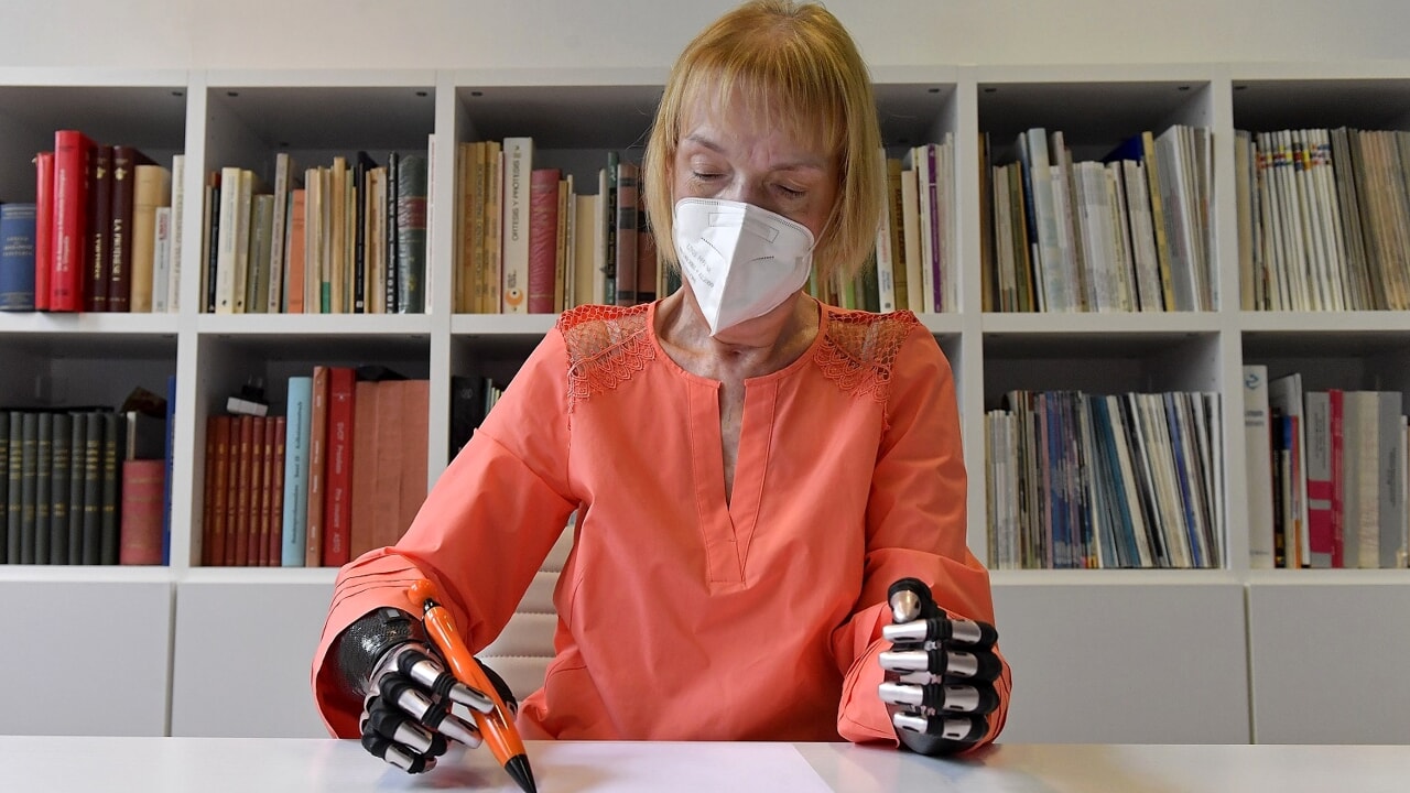 Una donna ha riacquistato l'uso delle mani grazie alle protesi più tecnologiche al mondo