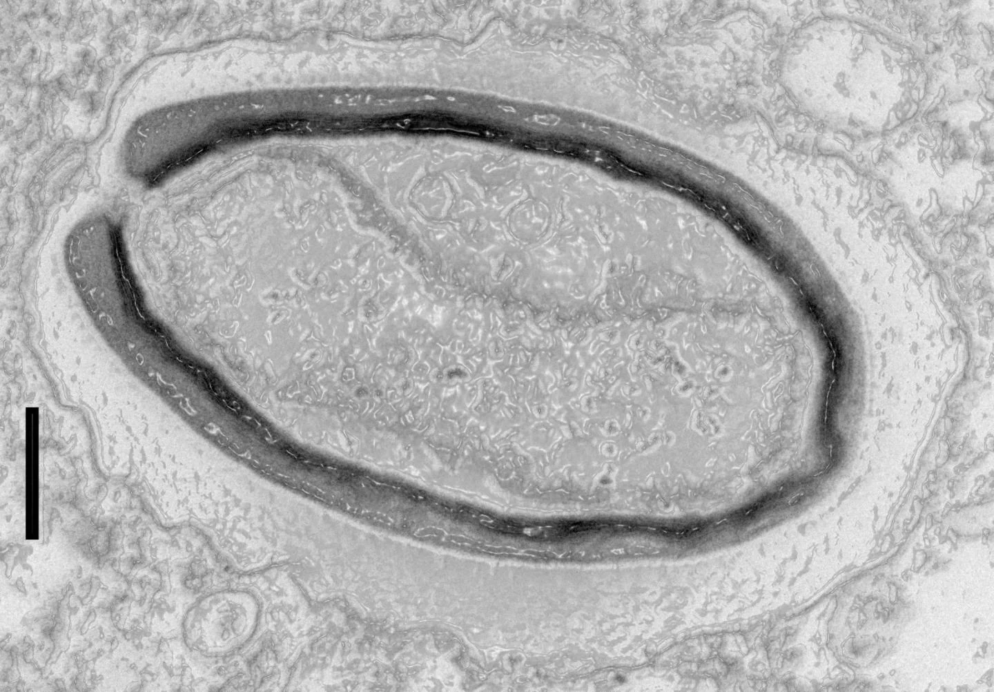 Pandoravirus, il Permafrost restituisce un virus di 50mila anni fa: ecco di cosa si tratta