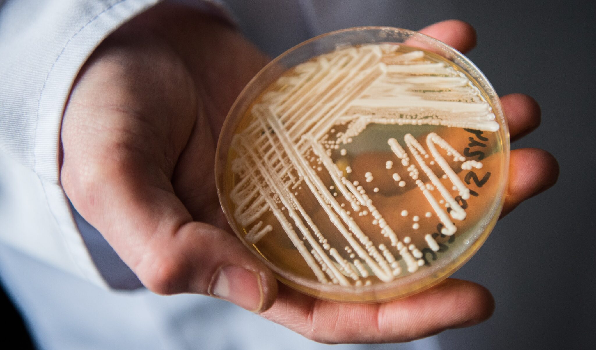 Cosa è la Candida auris, il fungo patogeno che può essere letale