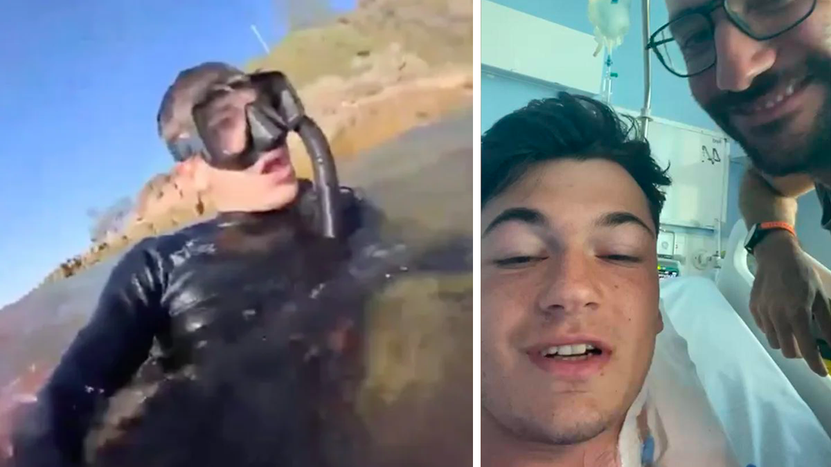 Un 20enne italiano viene aggredito da uno squalo (e perde una gamba), il video: "Aiuto, sto morendo!"