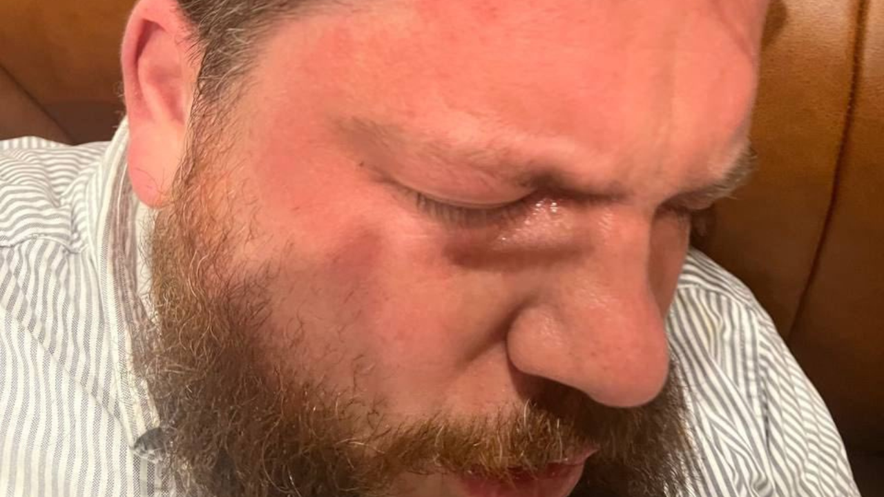 L'ex capo dello staff di Navalny è stato aggredito a martellate vicino alla sua casa in Lettonia